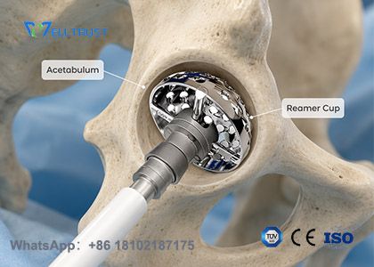 Acetabular Reamer:Reliable Orthopedic Instrument from Well Trust